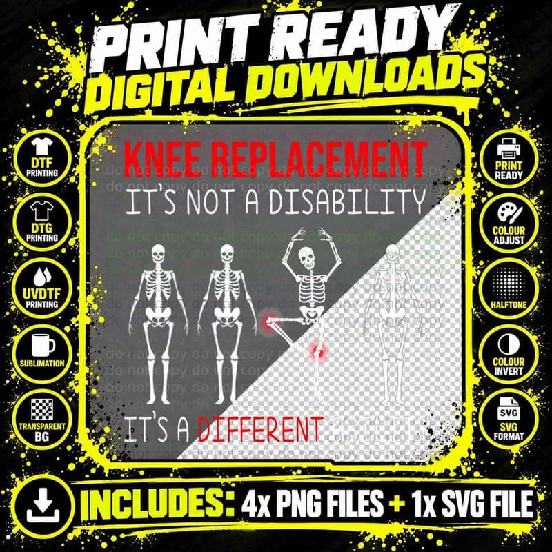 Funny Knee Replacement Surgery Recovery Hospital Classic Png SVG Digital Bundle