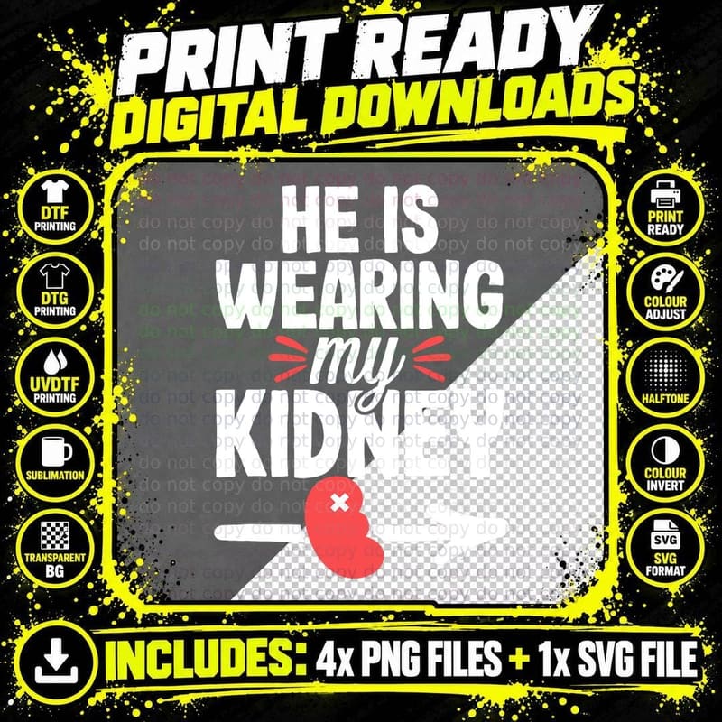 Funny Kidney Donation Transplant Organ Donor Joke Gag Png SVG Digital Bundle
